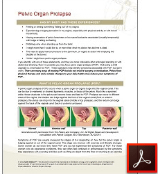 Pelvic Organ Prolapse, Patient Handout